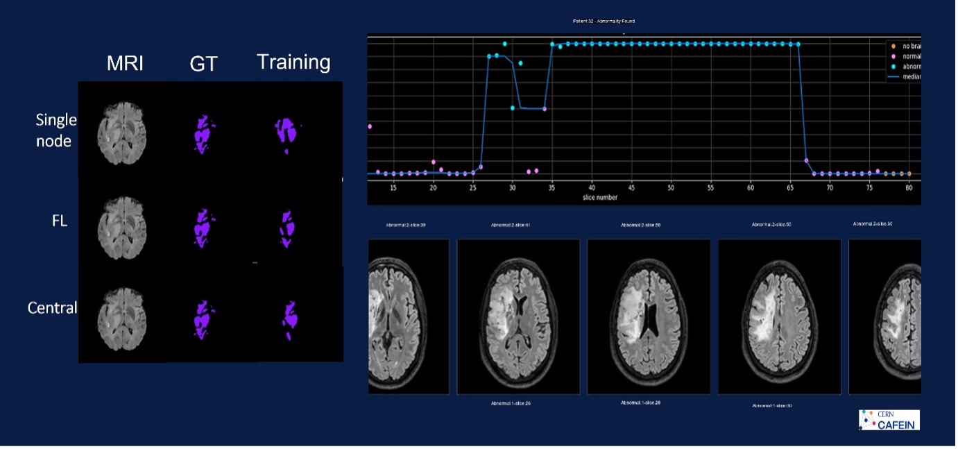 Performance convergence comparison and MRI brain images screening tool