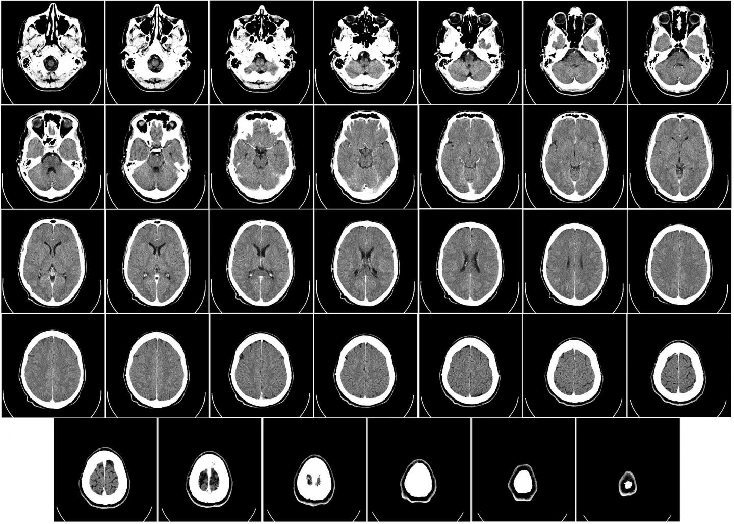 A dual-modality approach to motion-corrected tomography for medical applications A dual-modality approach to motion-corrected tomography for medical applications