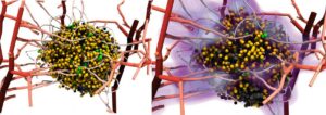 BioDynaMo: cutting-edge software helps battle cancer