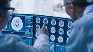 Accelerating stroke prevention