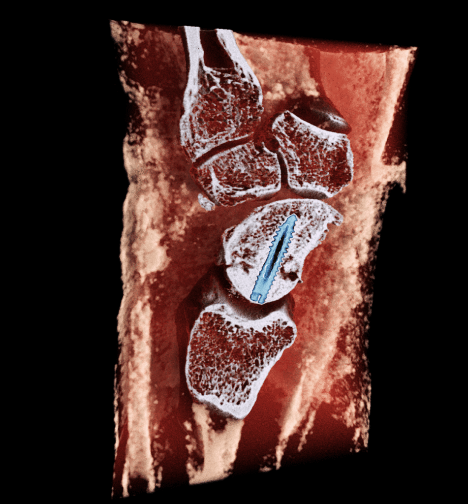 MARS Bioimaging partners with the Hospital for Special Surgery (HSS) | CERN Success Stories
