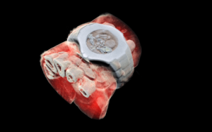 First 3D colour X-ray of a human using CERN technology