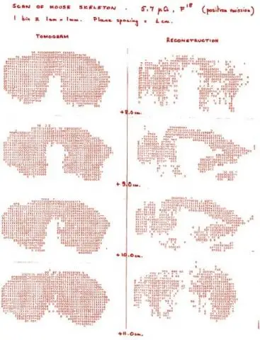 Forty years since the first PET image at CERN