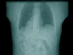 New open source medical imaging tools