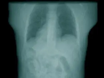 New open source medical imaging tools
