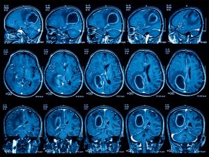 Computing Resources for medical applications