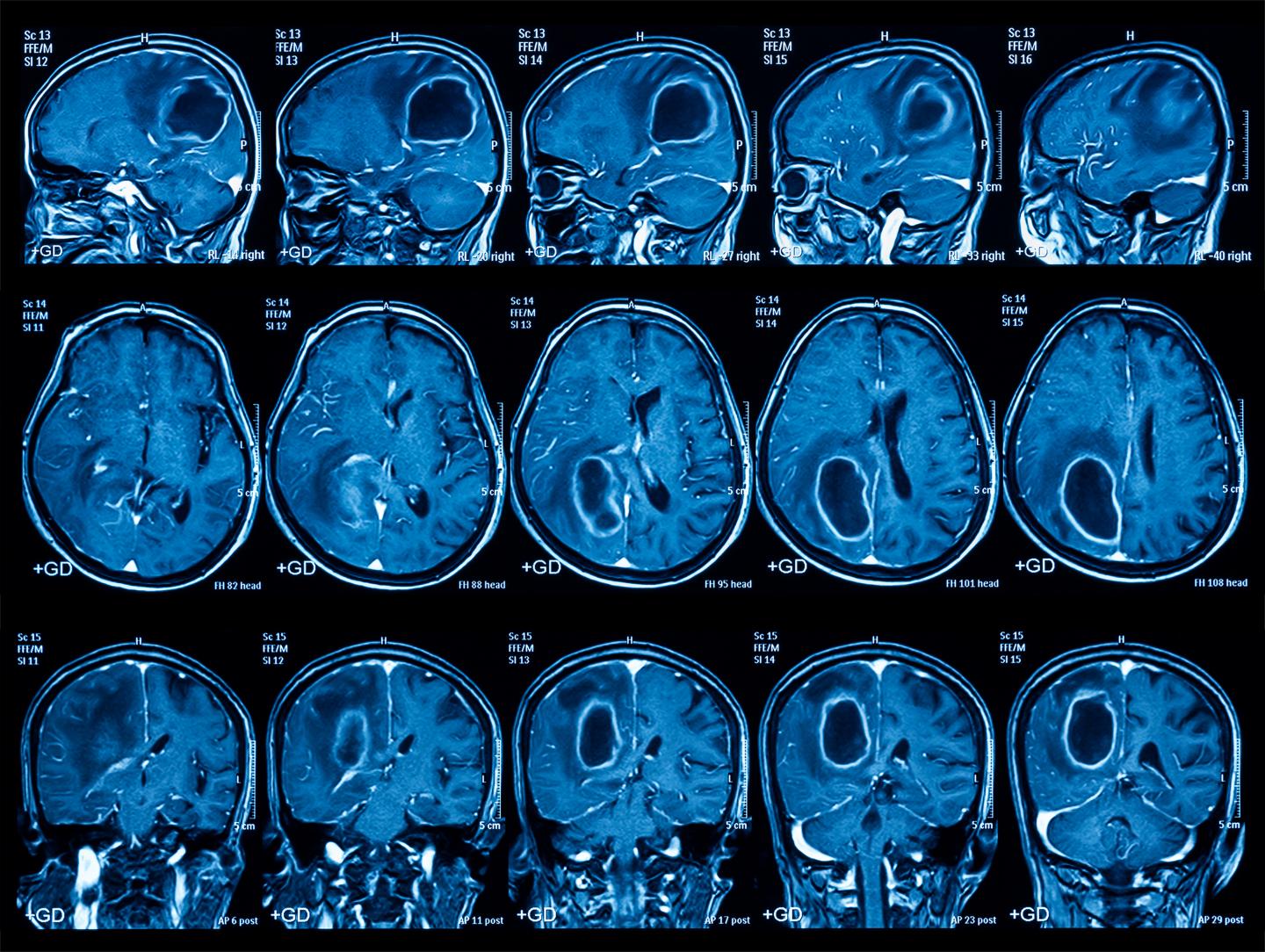 Computing Resources for medical applications